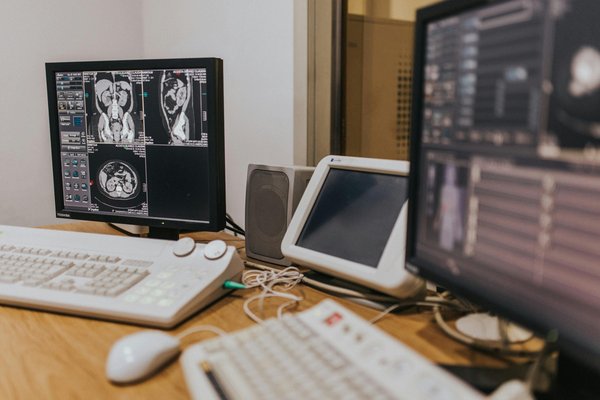Automatisation de la gonioscopie: révolution du diagnostic iridocornéen